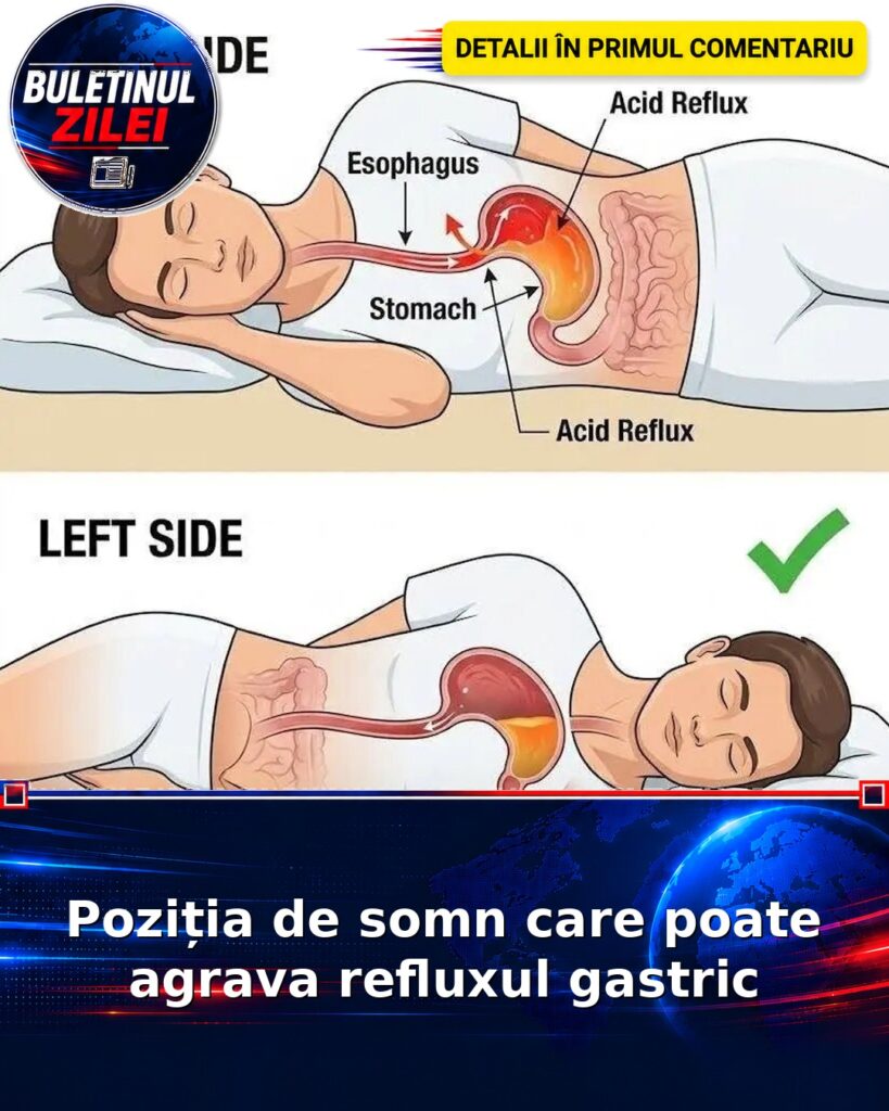 Poziția de somn care poate agrava refluxul gastric