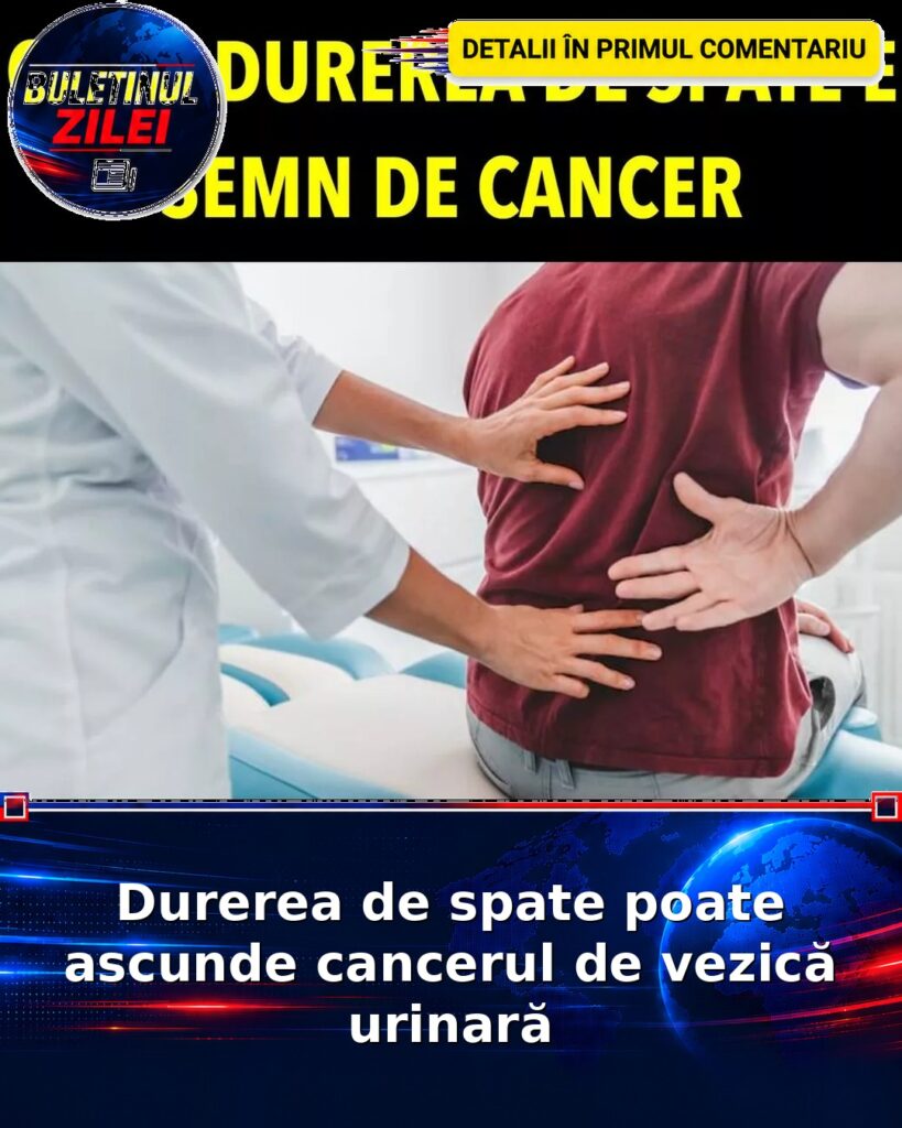 Durerea de spate poate ascunde cancerul de vezică urinară