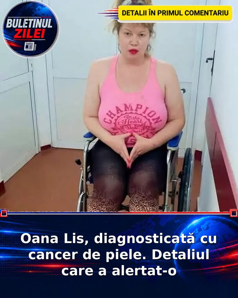 Oana Lis, diagnosticată cu cancer de piele. Detaliul care a alertat-o