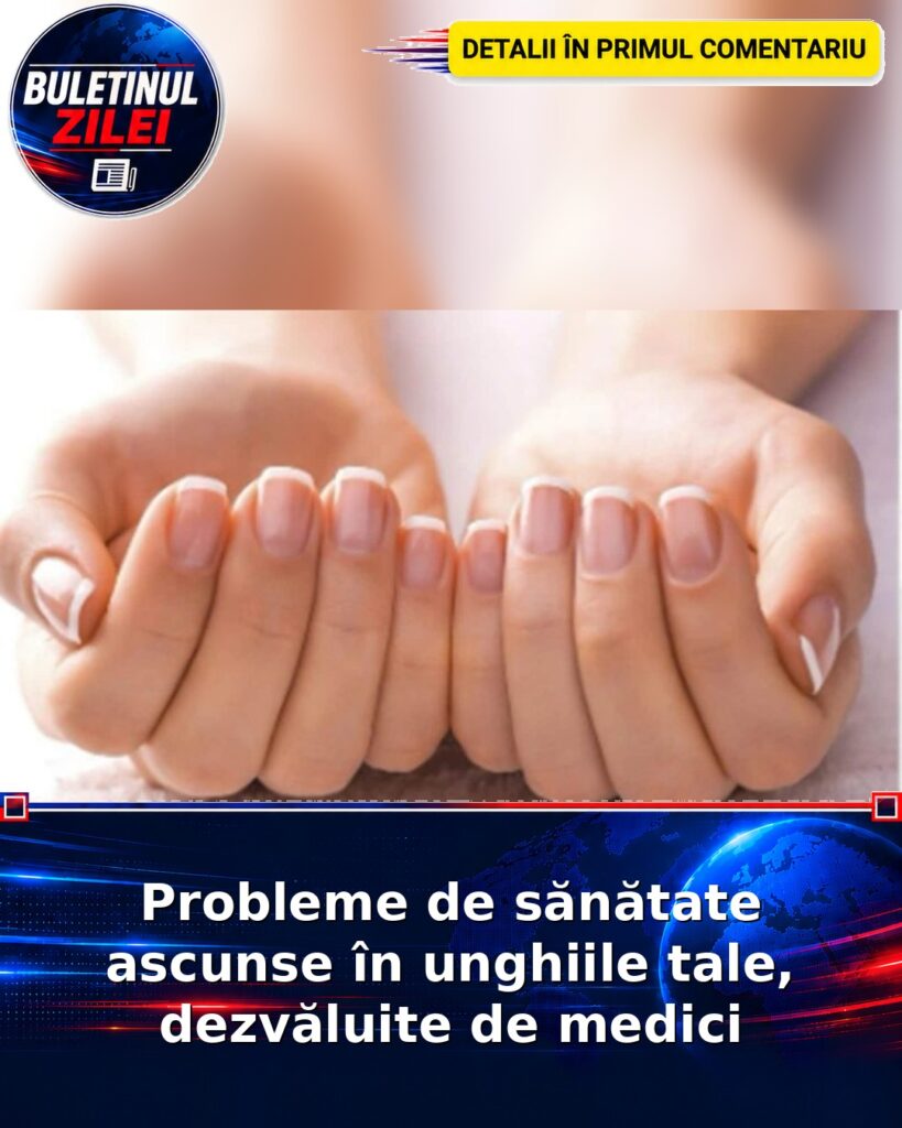 Probleme de sănătate ascunse în unghiile tale, dezvăluite de medici