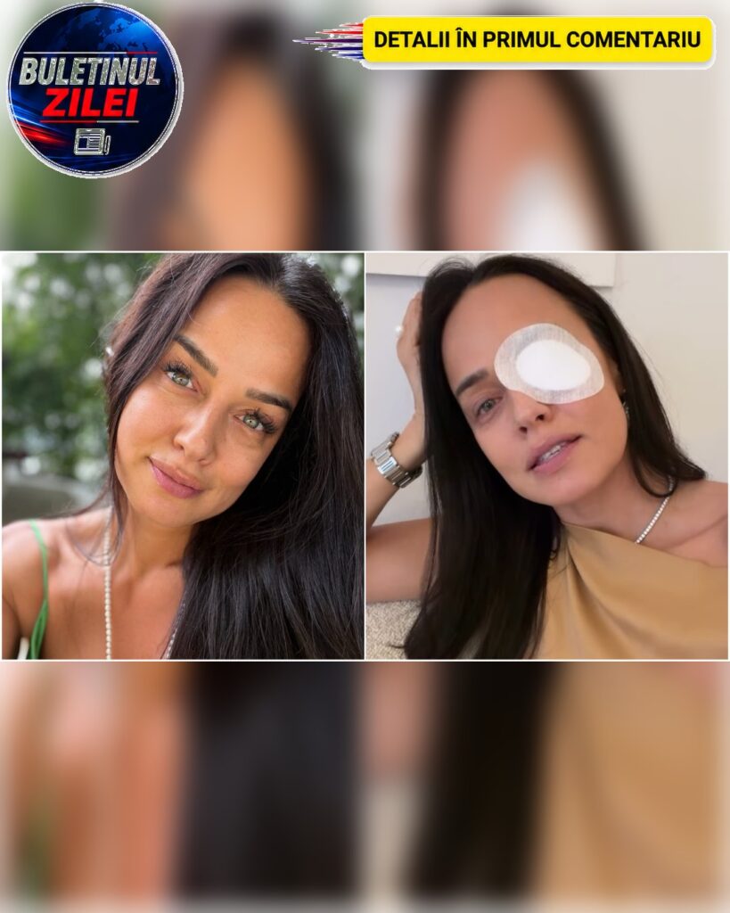 Andreea Raicu a apărut cu un ochi bandajat. Vedeta a ajuns la medic după ce câinele i-a rănit corneea