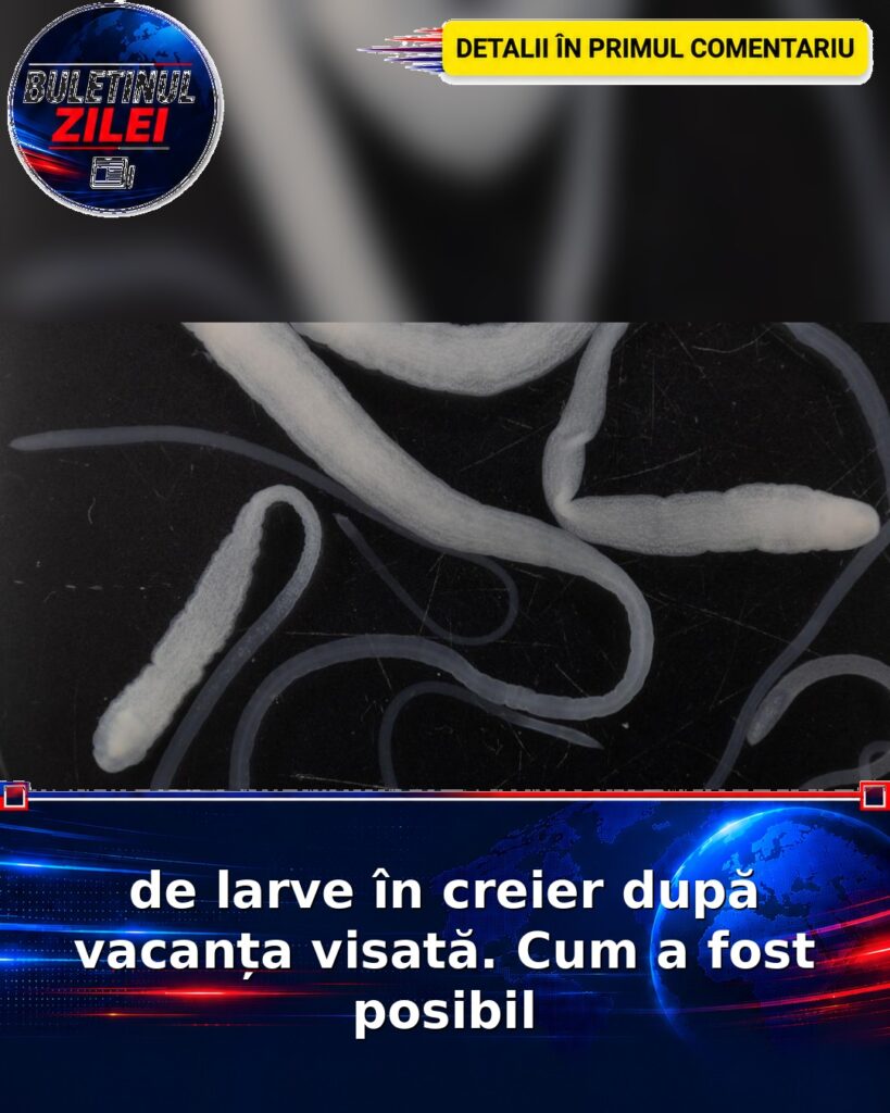 de larve în creier după vacanța visată. Cum a fost posibil