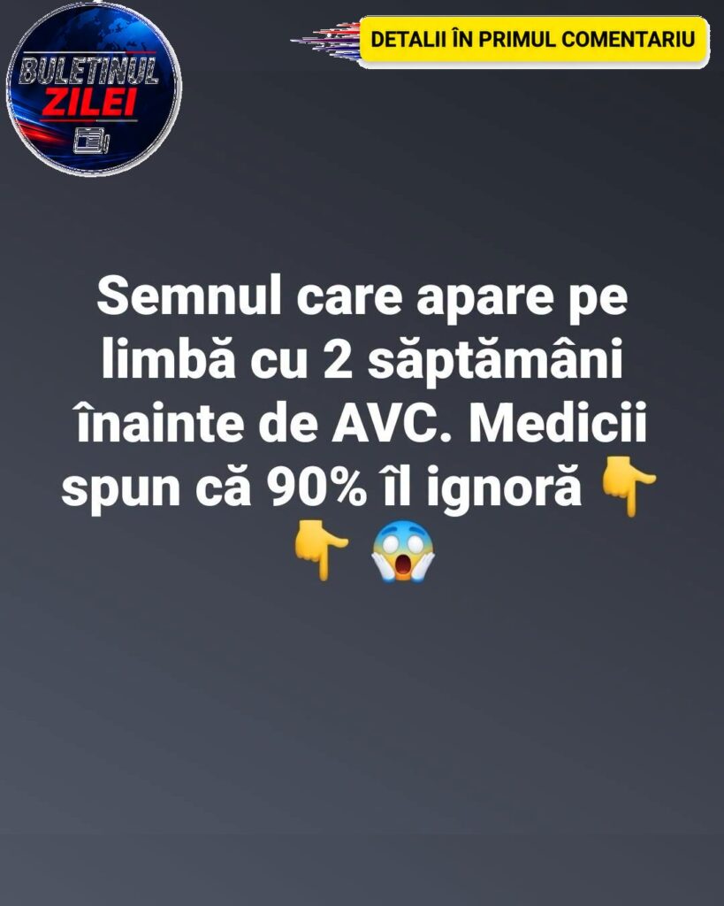 Limba, primul semnal că un accident vascular cerebral poate fi iminent