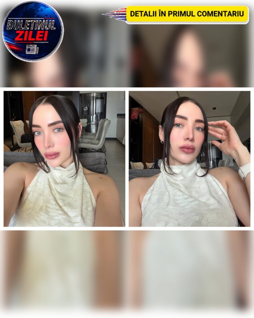 O influenceriță a murit la 30 de ani în urma unei intervenții estetice. Autoritățile au deschis o anchetă