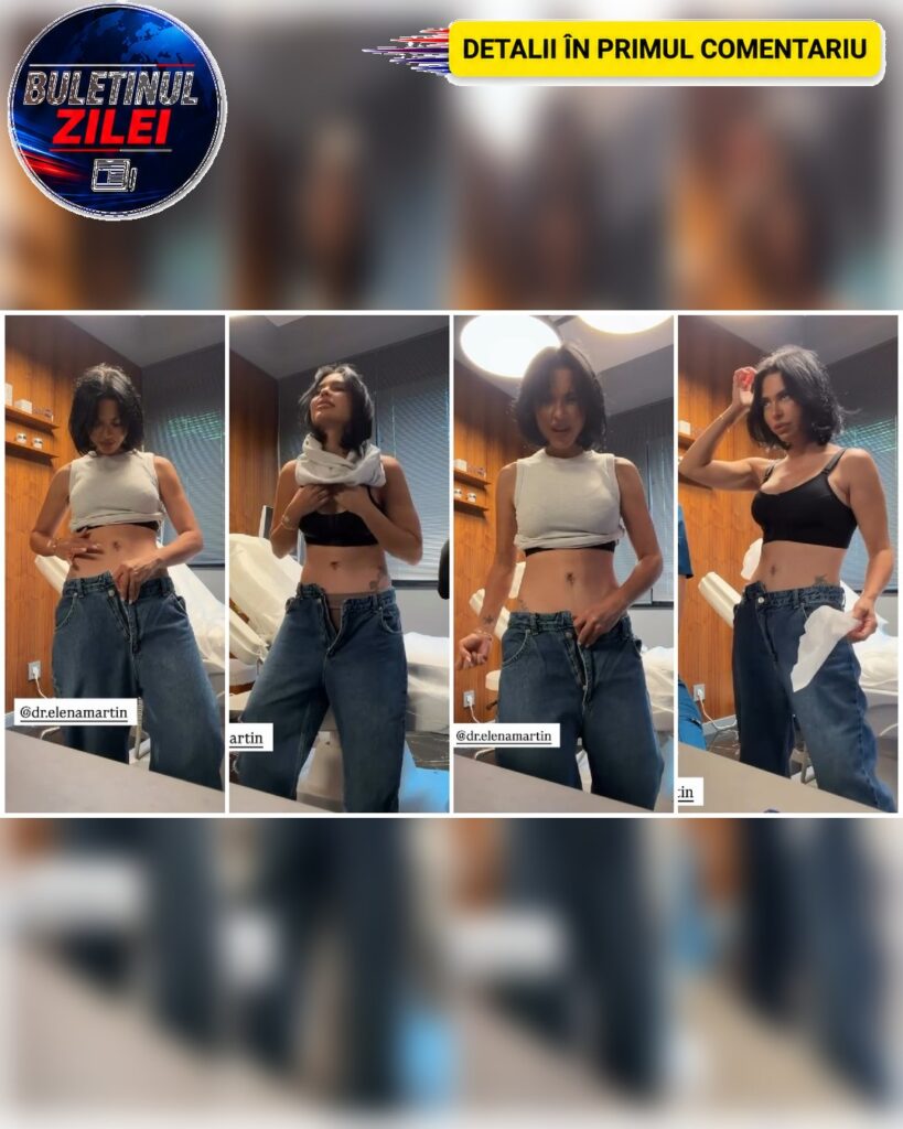 Cum arată abdomenul Andreei Popescu la douăsprezece zile de la abdominoplastia reversă