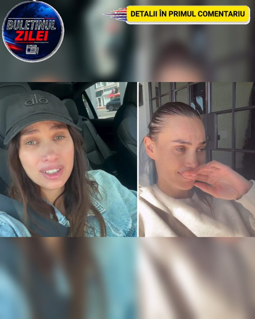 Alina Pușcău se confruntă cu efectele secundare ale tratamentului pentru cancer. Îi cade părul