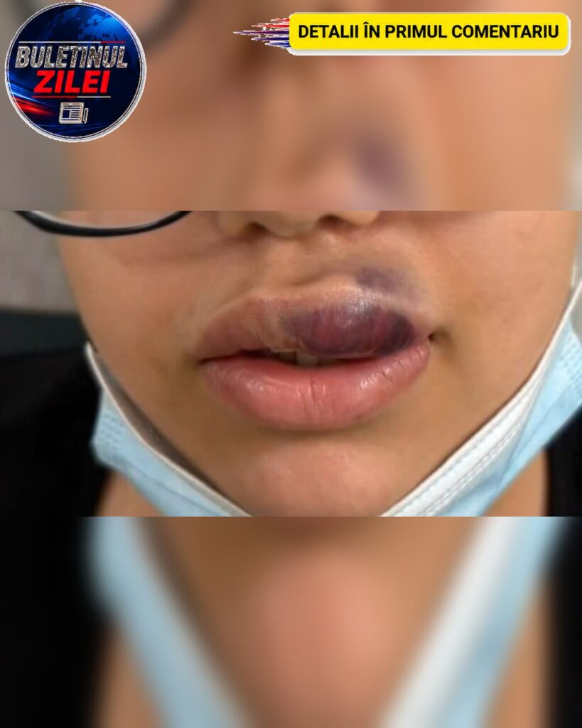 Proceduri estetice ilegale la Oradea. O femeie a fost reținută după ce o tânără a ajuns la spital