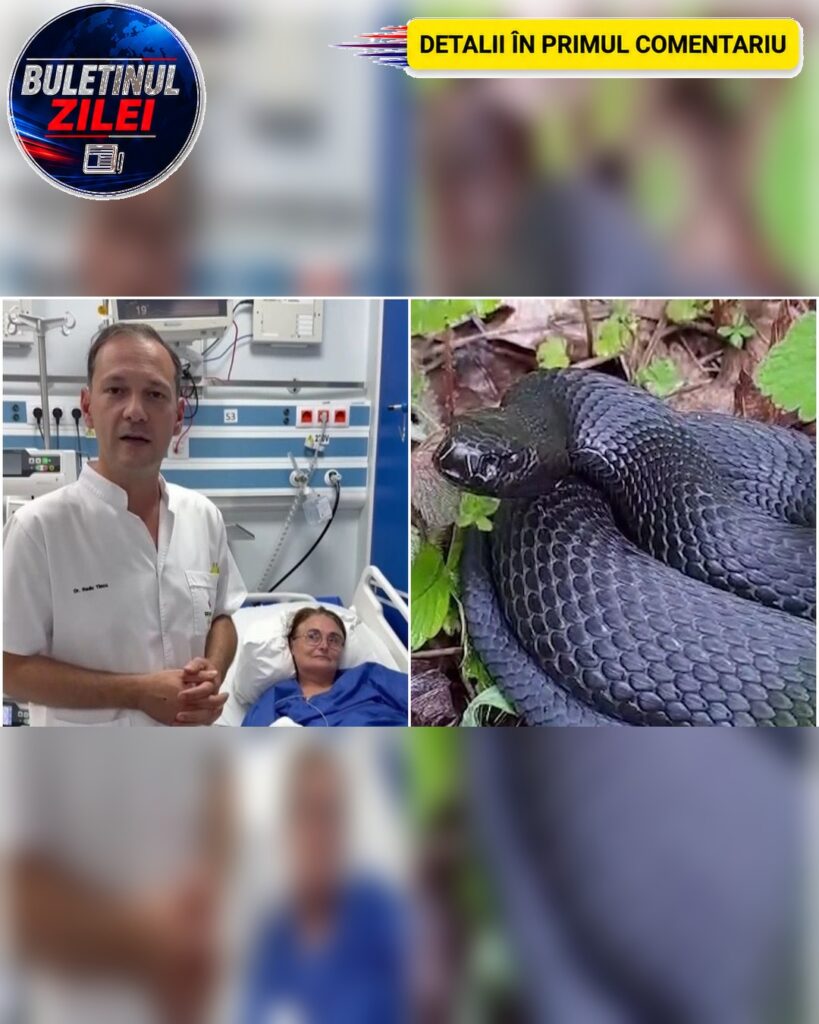 O femeie a ajuns la Spitalul Floreasca după ce a fost mușcată de un șarpe chiar în…